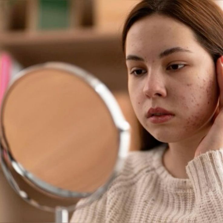 Cara Mengatasi Wajah yang Tidak Cocok dengan Skincare