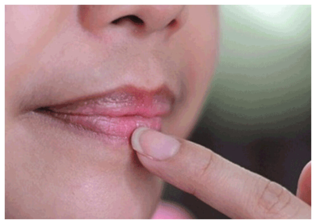 Tips Efektif Mengatasi Bibir Hitam Secara Alami
