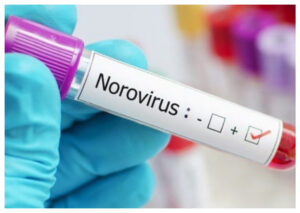 Norovirus: Gejala, Penularan, dan Tindakan Pencegahan