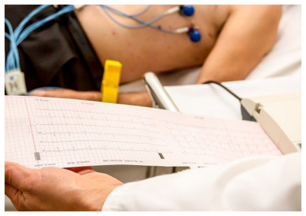 EKG, Ini Manfaatnya dalam Diagnosis Penyakit Jantung