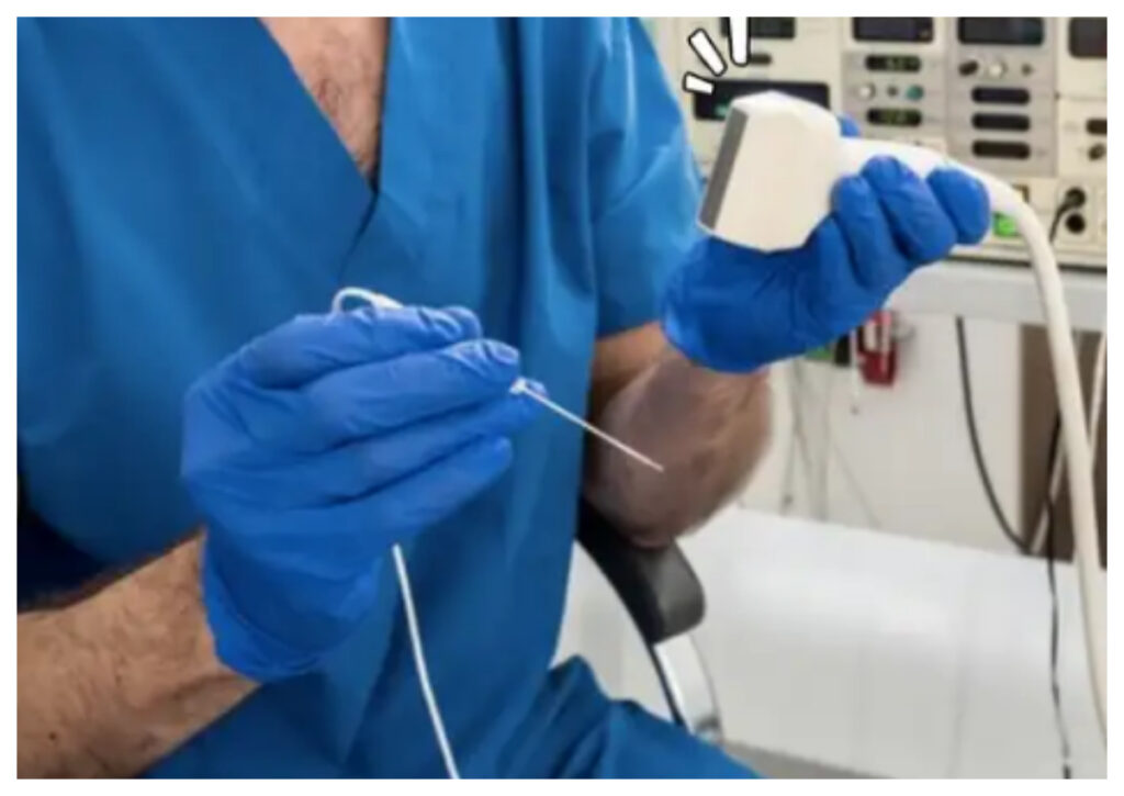 Ablasi Jantung: Tindakan Medis Atasi Gangguan Irama Jantung