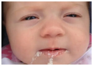 Kenali Tanda-Tanda Muntah pada Bayi yang Harus Diwaspadai