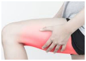 Cedera Hamstring: Penyebab, Gejala, dan Cara Penanganannya