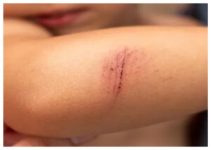 Salah Bawa Mobil Pengemudi Taksi Online Dianiaya Rekannya