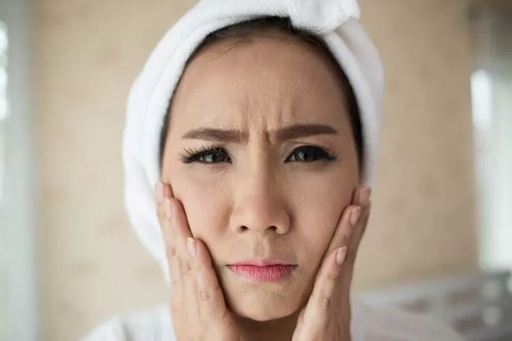 Mengapa Wajah Terasa Panas dan Perih Saat Menggunakan Skincare