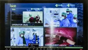 Pertama di ASEAN, RSCM Lakukan Operasi Jarak Jauh Pakai Robot