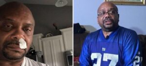 Dikira Terserang Pilek Biasa, Eh Ternyata Otaknya Bocor…