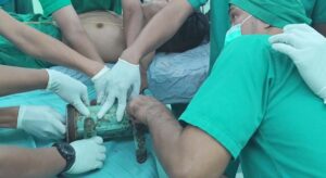 Tim SAR Bantu Lepas Tangan Pekerja yang Terjepit Mesin Bakso