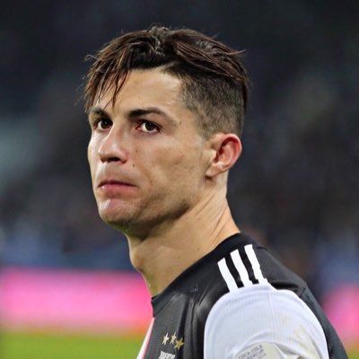Cristiano Ronaldo Operasi Plastik