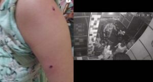 Siswi SMP di Semarang Diberondong Tiga Tembakan Airsoftgun