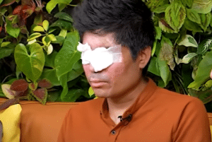 Agus Salim Korban Penyiraman Air Keras Kini Bisa Melihat Lagi, Begini Kisah Penuh Haru di Baliknya