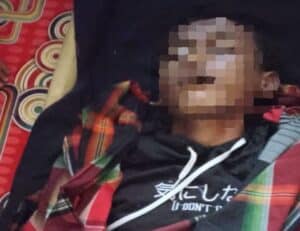 Remaja di Garut Tersambar Petir saat Bermain di Persawahan