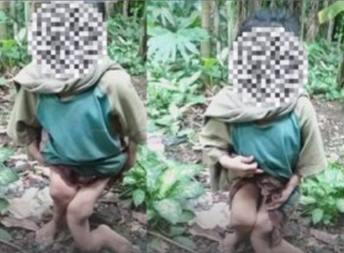 Kisah Pilu Bocah 10 Tahun Alami Sentuhan Keras Bertahun-tahun Oleh Keluarga Hingga Kakinya Tak Berbentuk