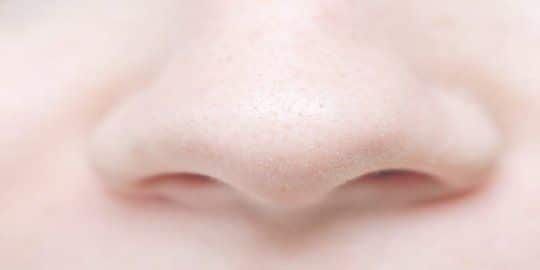 Skincare untuk Komedo Putih