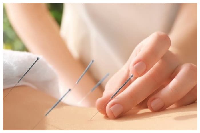 Panduan Pengobatan Alternatif: Manfaat dan Keamanan Berbagai Metode