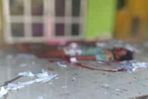 Ledakan Petasan Lukai 2 Warga Lombok Tengah, Ibu Jari dan Telunjuk Tangan Kiri Putus