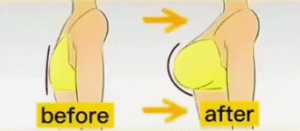 5 Olahraga untuk Membesarkan Payudara Tanpa Alat