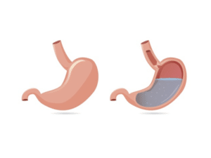 5 Bahan Alami untuk Meredakan Gejala Asam Lambung (GERD)