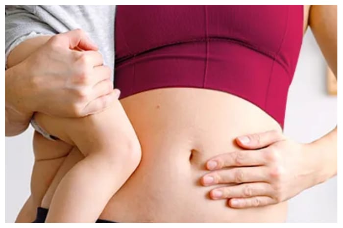 Ini Tanda Pemulihan Luka Operasi Caesar dan Tips Perawatannya