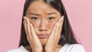 Pakai Skincare Malah Kusam? Ini Penyebab dan Solusi Ampuhnya!