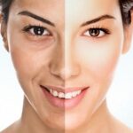 Skincare Lokal untuk Kulit Kering dan Kusam