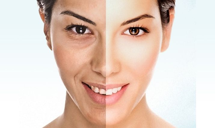 Rekomendasi Terbaik Skincare Lokal untuk Kulit Kering dan Kusam