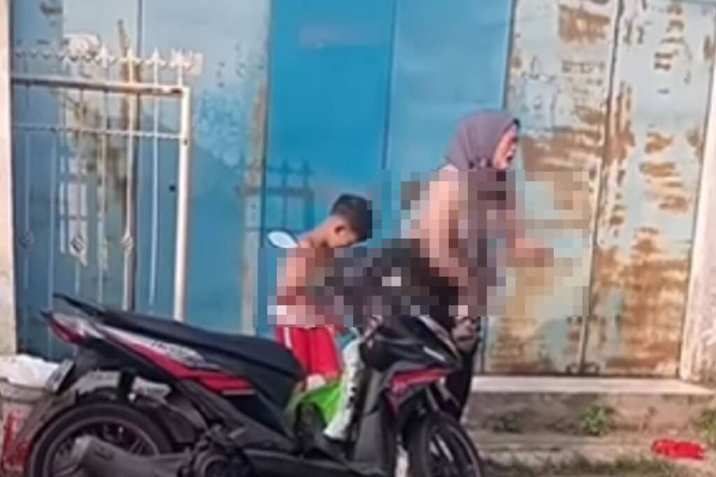 Jeritan Pilu di Sukabumi, Ibu dan Anak Jadi Sasaran Serangan Air Keras!