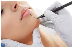 Mengenal Operasi Plastik: Jenis, Manfaat dan Risikonya