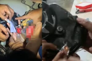 Satset! Damkar Keluarkan Jari Remaja yang Jarinya Tersangkut Bak Mesin Motor