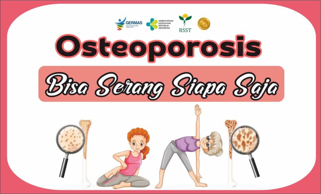 Ilmuwan Temukan Protein ‘Pengganti Olahraga’, Tulang Tetap Kuat Meski Tanpa Banyak Gerak