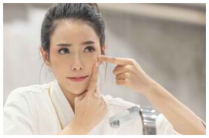 6 Cara Menghilangkan Komedo Putih dan Hitam Secara Efektif