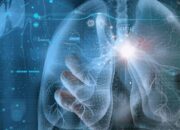 Era Baru Mendeteksi Kanker dengan AI Dolphin Temuan Universitas McGill Kanda