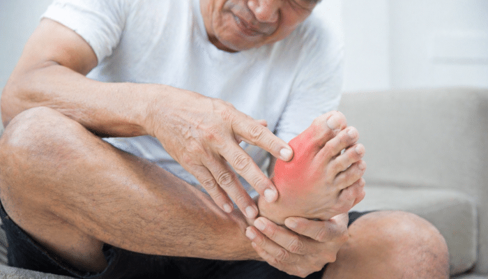 5 Makanan Mengandung Purin Tinggi yang Harus Dihindari Penderita Asam Urat