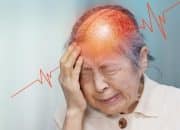 5 Tips Mencegah Stroke Sejak Dini, Langkah Sederhana untuk Hidup Lebih Sehat